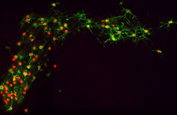 rabies based tracing