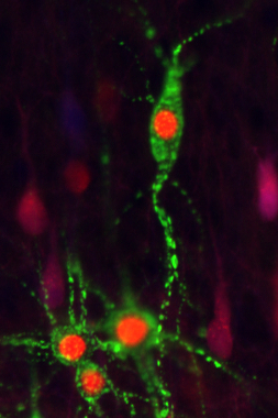 ABRVFITC_H2BRVtdtomatoCX2